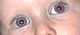 Exemple del filtre «Elimina els ulls vermells»