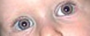 Example for the Red Eye Removal filter